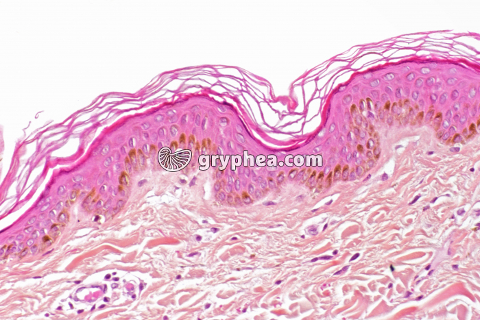 Peau pigmentée x100 - gryphea.com